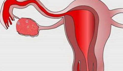 西安治疗输卵管堵塞最好的方法是什么